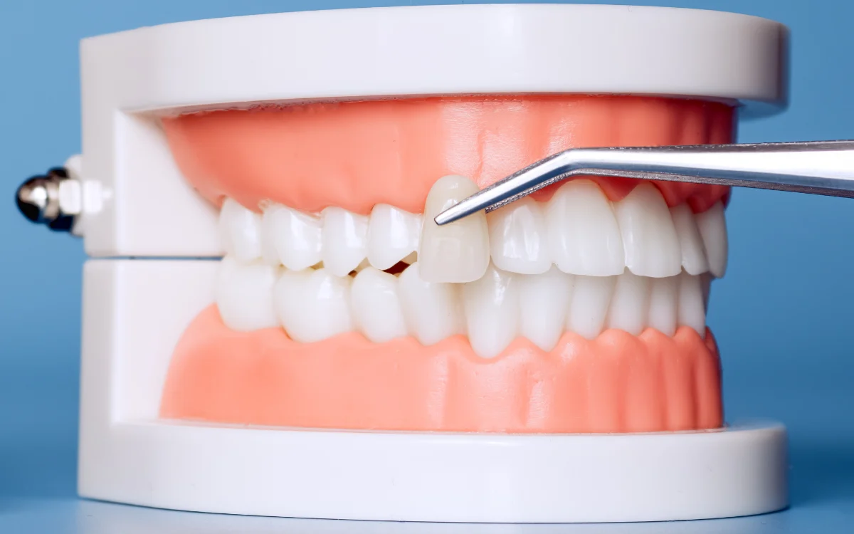 Cosmetic Dentistry
